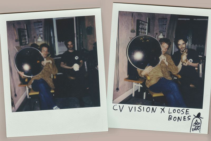 Loose Bones w/ CV VISION