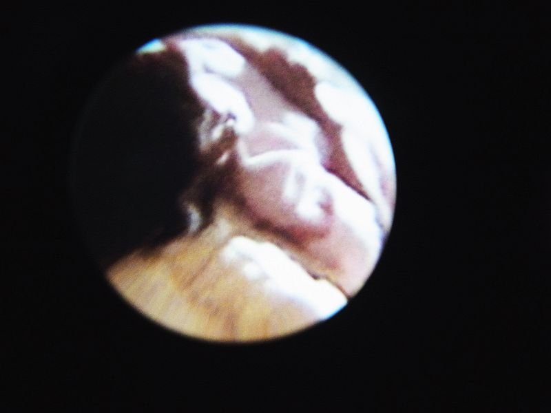 LOST AREA W/ SELFANDOTHERS