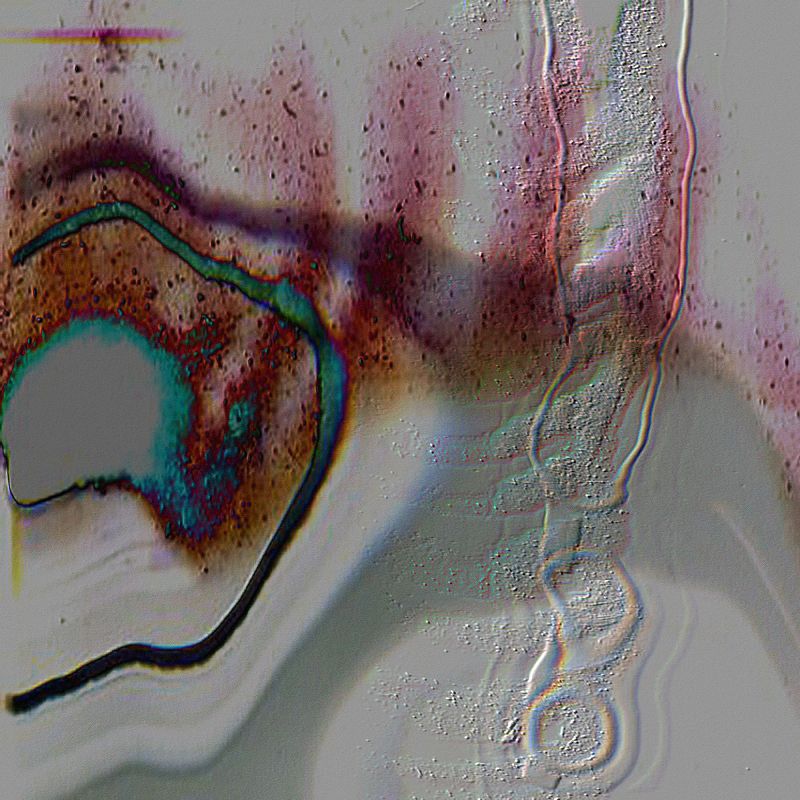 S K Y A P N E A w/ Dale Cornish & Sim Hutchins